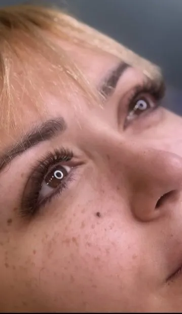 بعد — اکتنشن مژه طبیعی