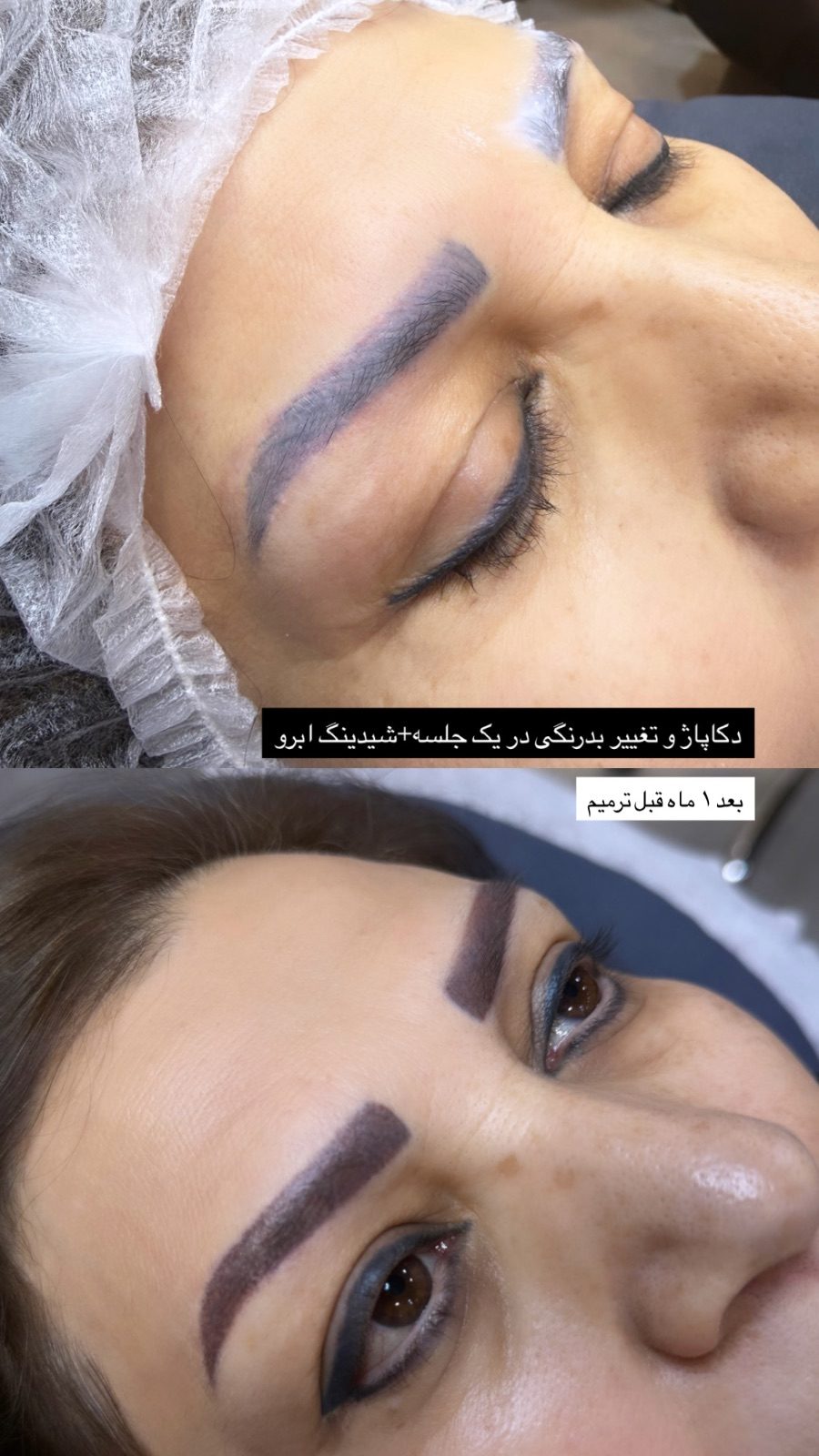 عکس قبل به همراه عکس بعد از دکاپاژ بد رنگی تتو قدیمی بعد ۳۰  — کارِ درسا در سالن زیبایی نیل تهرانپارس