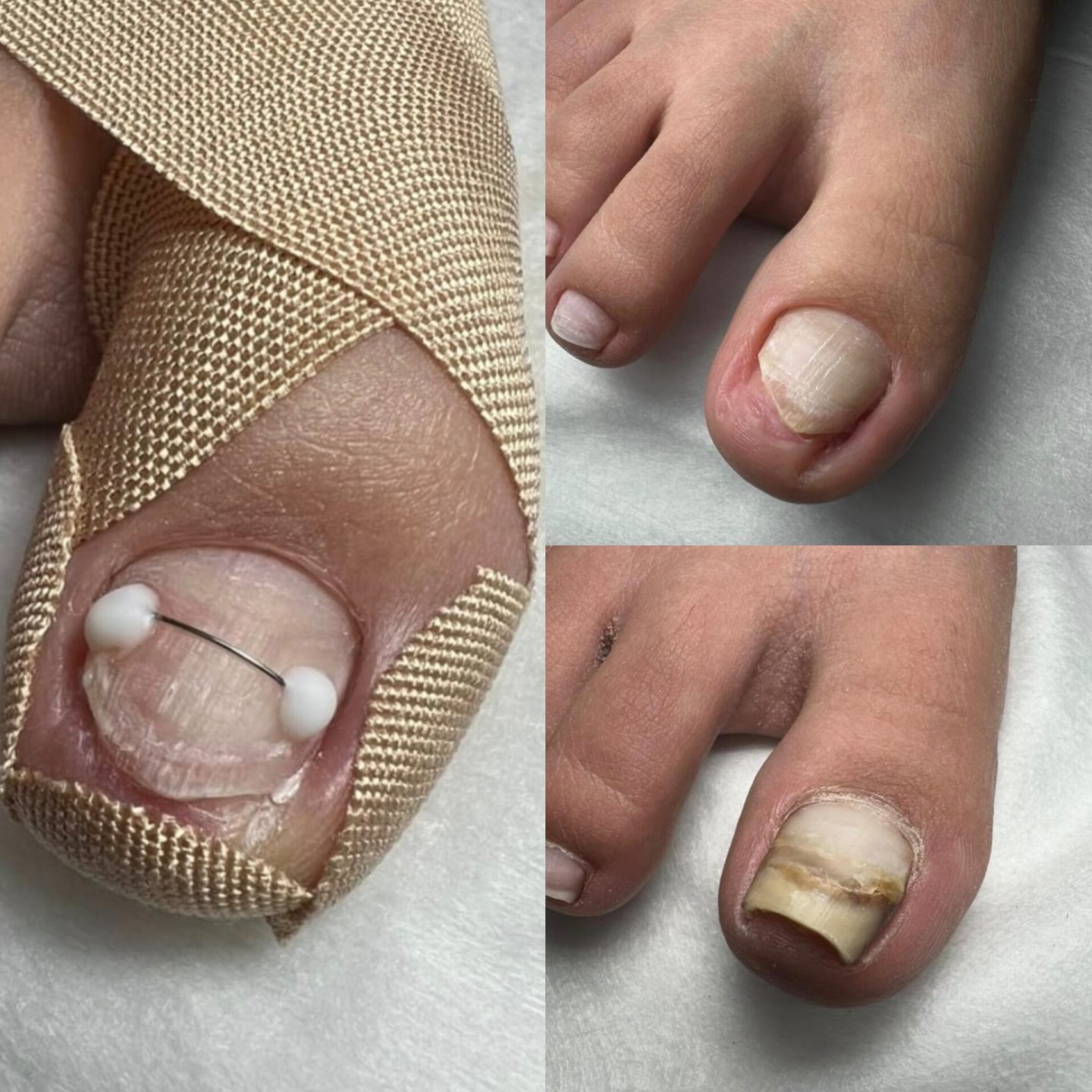 ناخن — نمونه کار سالن زیبایی نیل تهرانپارس، کار اتنا