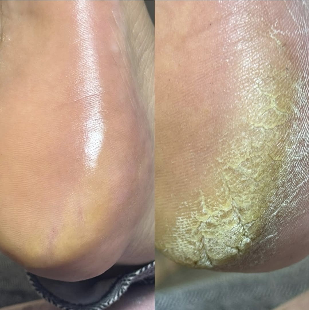 پدیکور درمانی کفسابی اسپا