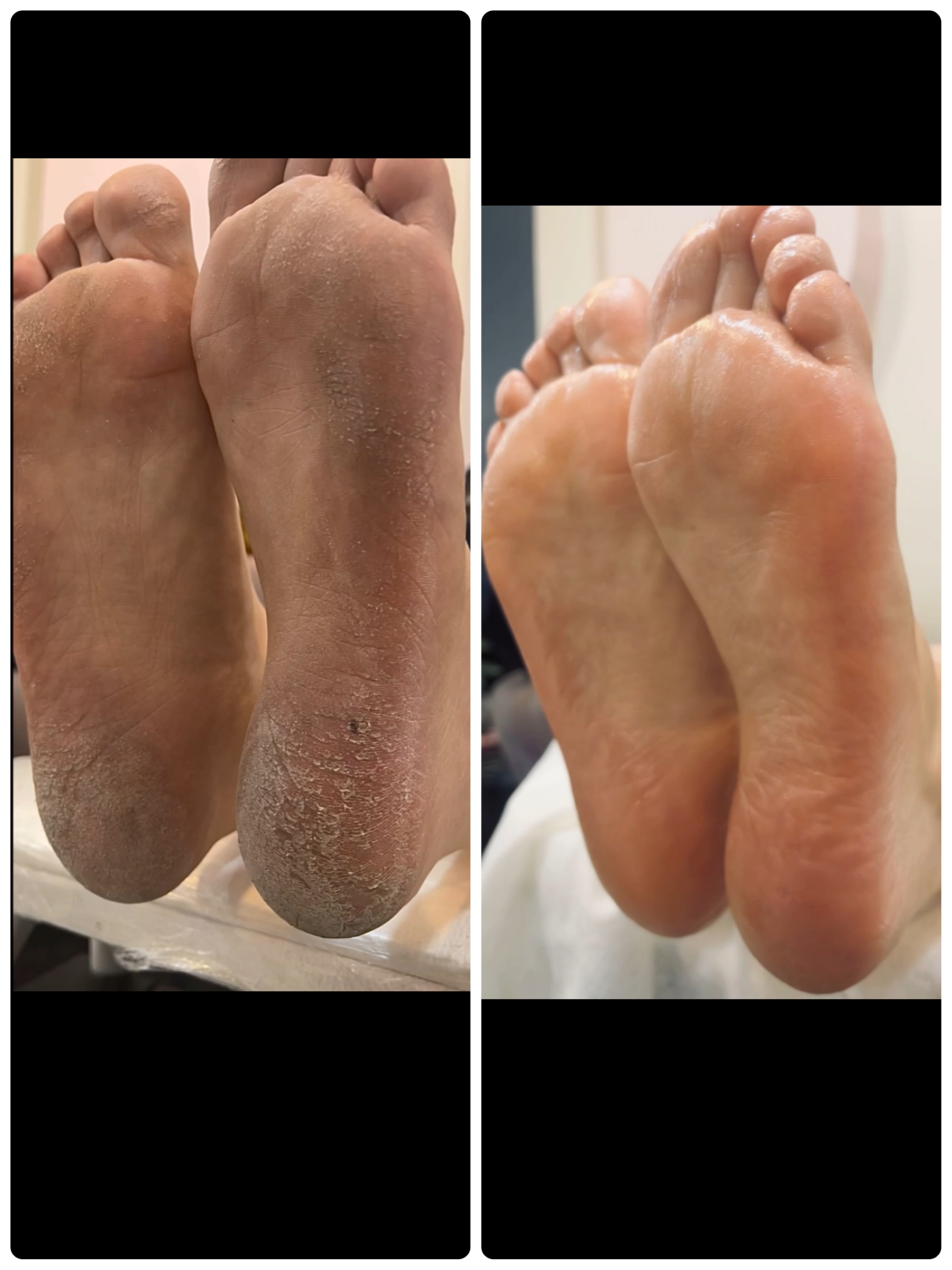پدیکور کفسابی اسپا