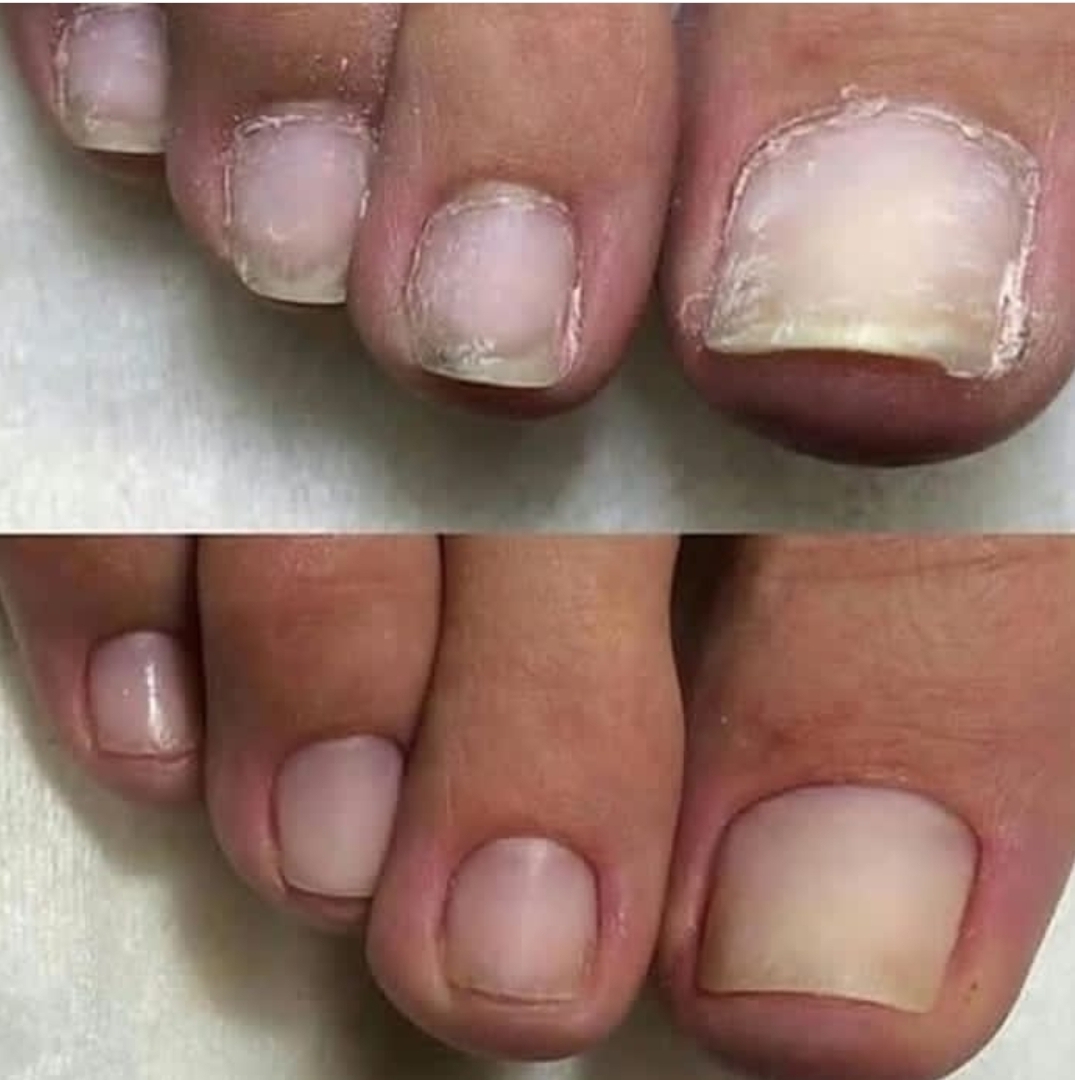 پدیکور درمانی کفسابی اسپا