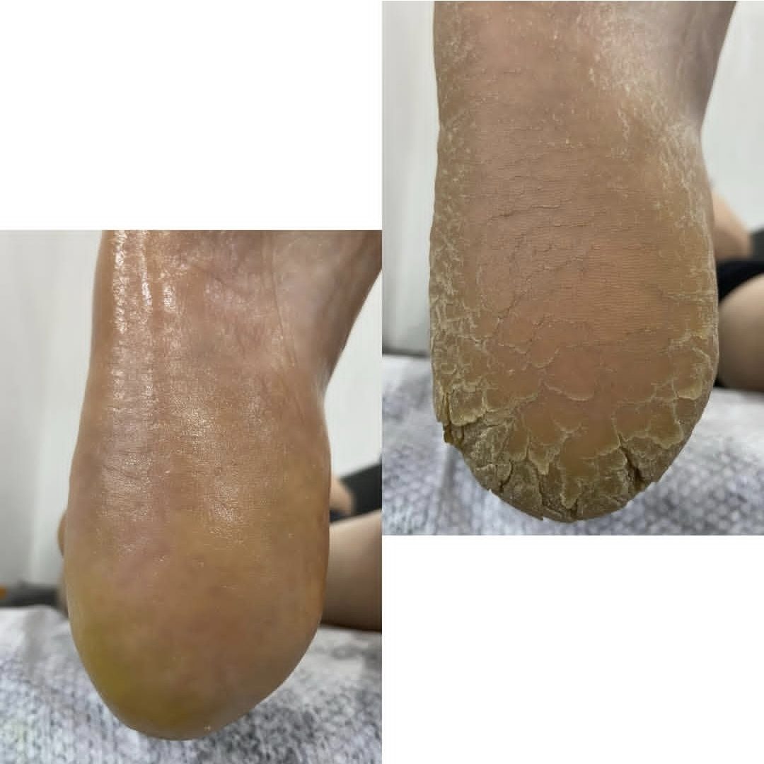 پدیکور — نمونه کار سالن زیبایی نیل تهرانپارس، کار اتنا