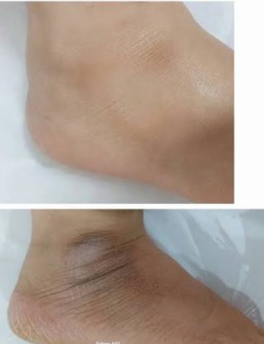 ناخن — نمونه کار سالن زیبایی نیل تهرانپارس، کار مریم