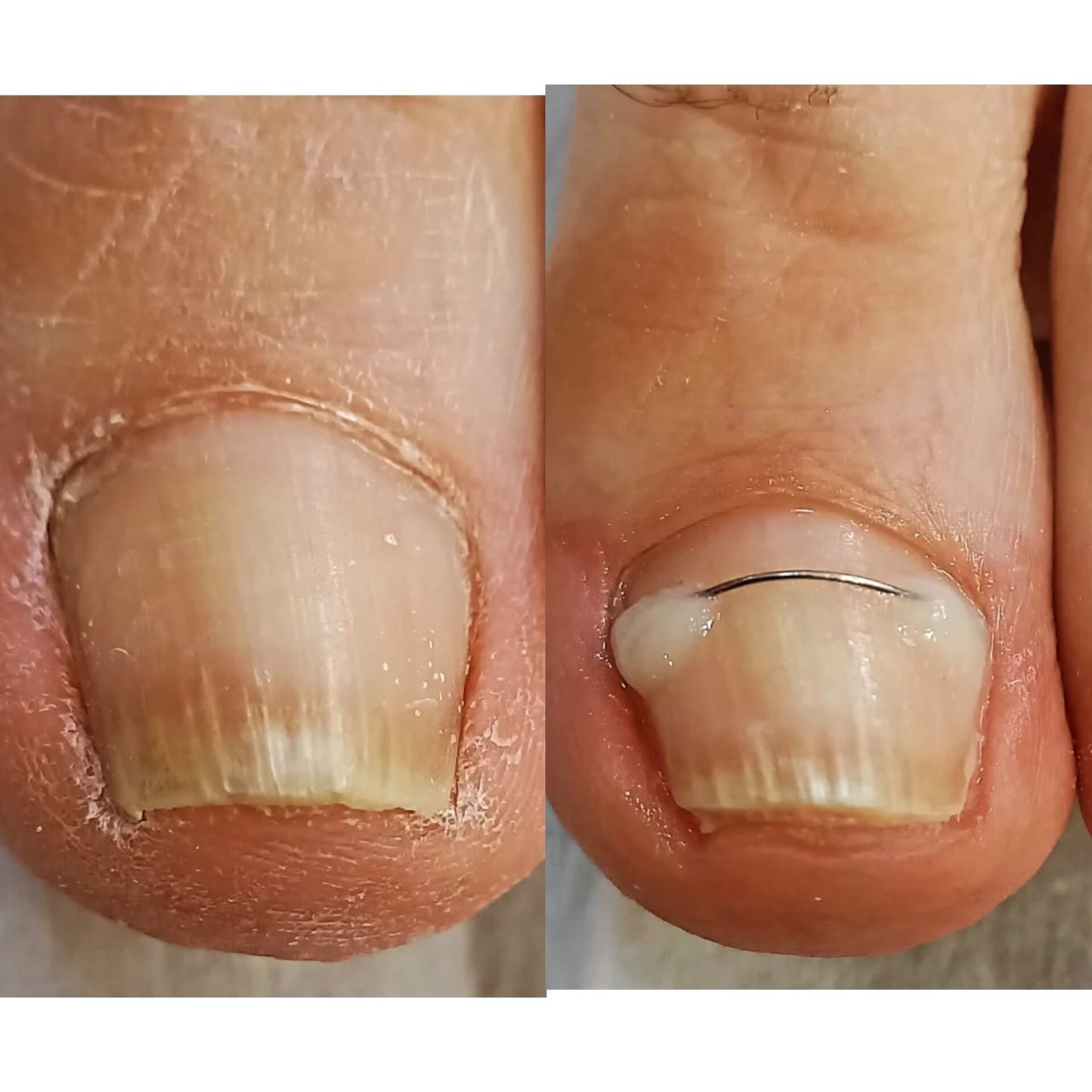 پدیکور — نمونه کار سالن زیبایی نیل تهرانپارس، کار اتنا